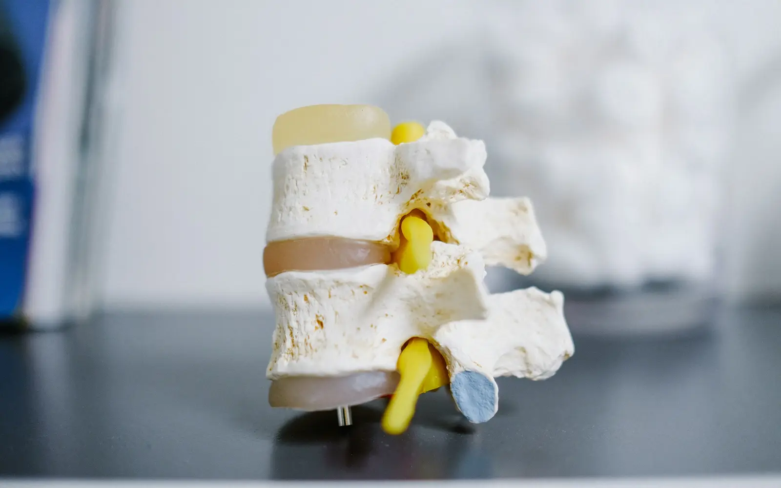A model of two lumbar vertebrae with the disc between them, on a dark table.