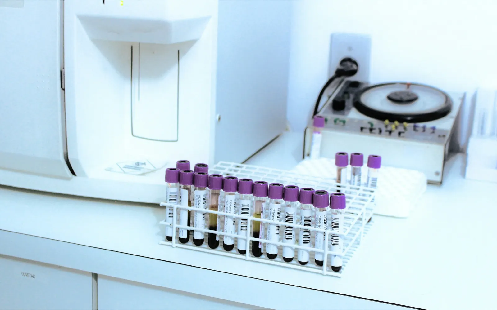 A rack of labelled blood sample tubes with purple caps on a laboratory bench beside analysis equipment.