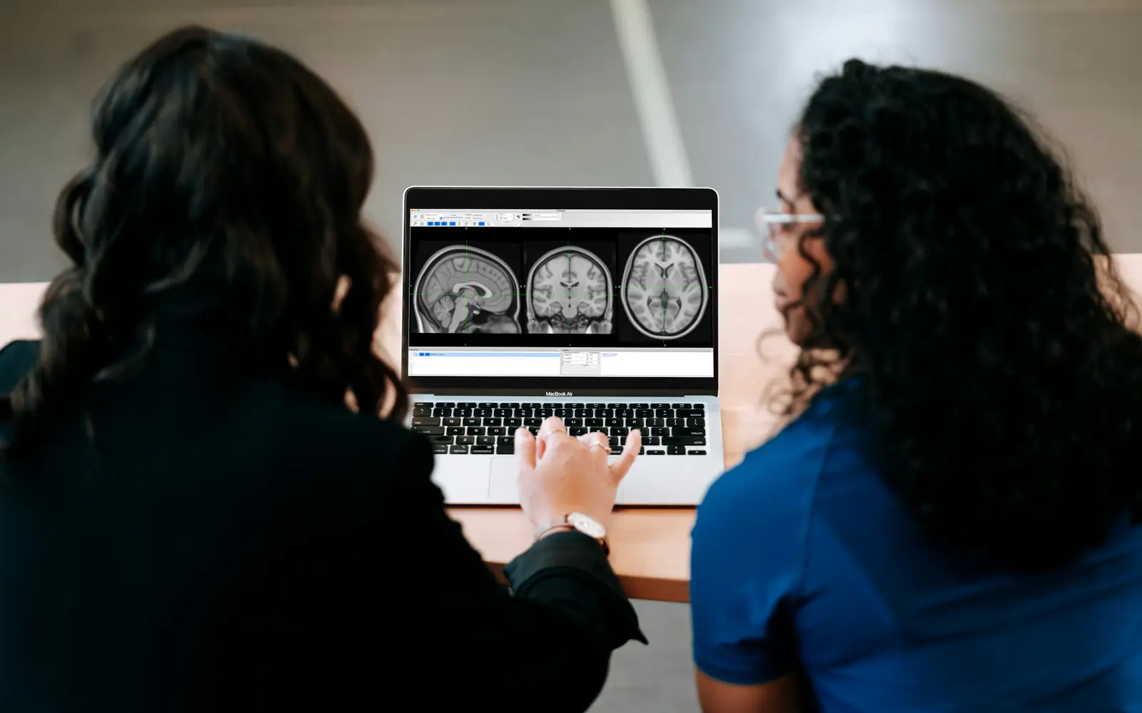 Two women look at brain MRI images on a laptop screen.