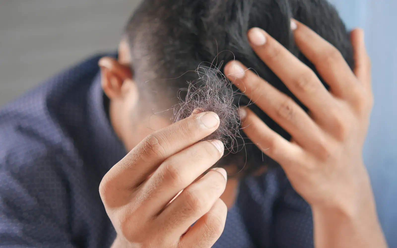 A man runs his fingers through his hair, checking his scalp and hairline.